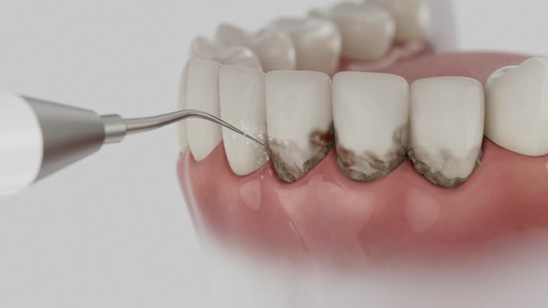 Trusted Dental Implants service in Keokuk, IA - Dentist Open Now